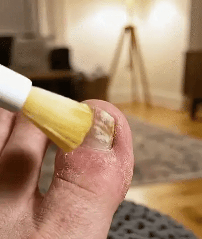 KeraNails Secretul Unghiilor