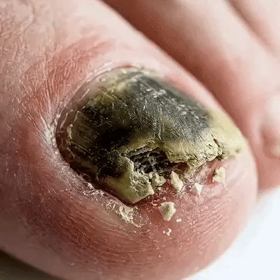 KeraNails Secretul Unghiilor