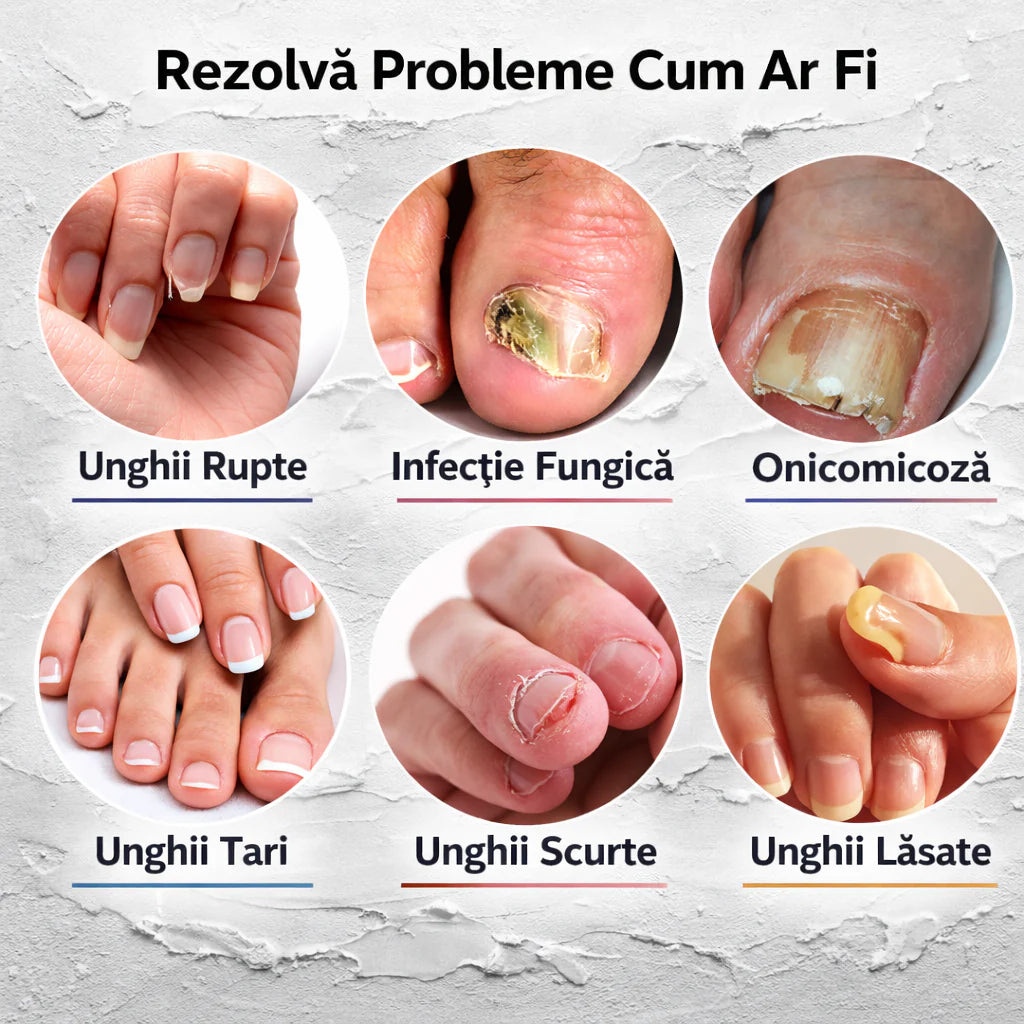 Ulei Antifungic