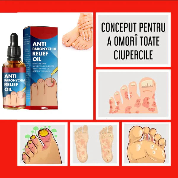 Ulei Antifungic